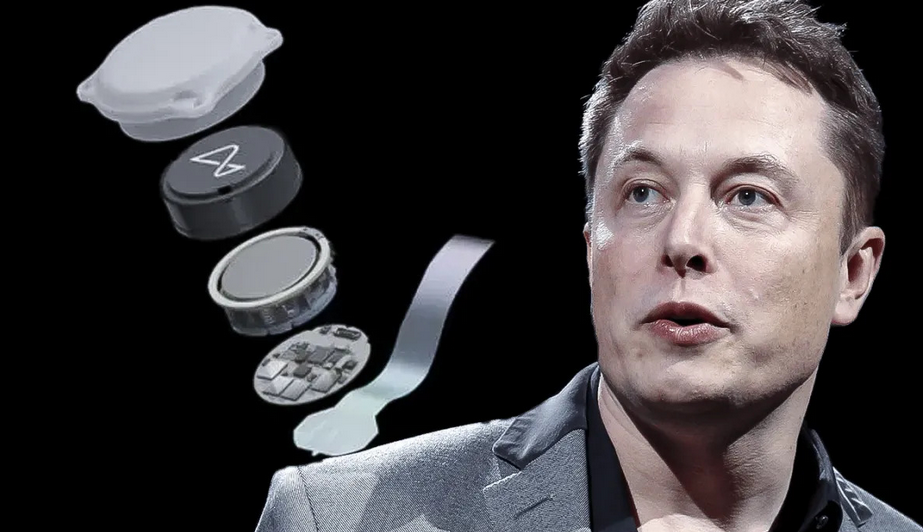 AFIRMAN QUE EL "CHIP CEREBRAL" QUE ANUNCIÓ ELON MUSK "EXISTE HACE 20 AÑOS"